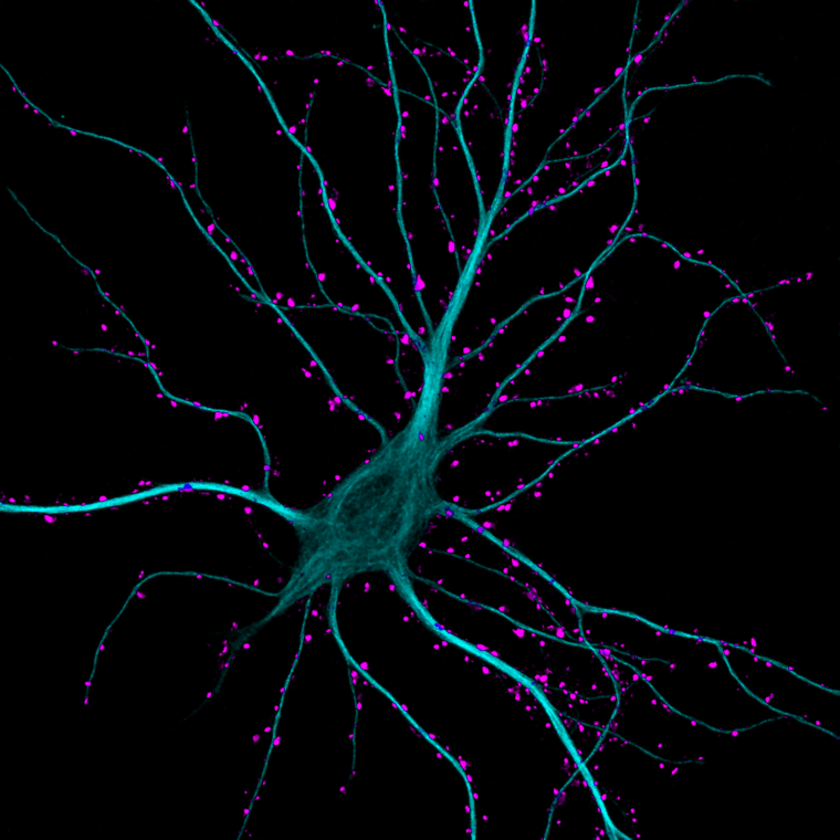 Dr. Kieran Boyle
University of Glasgow, Institute of Neuroscience and Psychology
Glasgow, Scotland, UK
Hippocampal neuron receiving excitatory contacts
Fluorescence and Confocal
63X
[Improvision Data]

ImageName=
TimeStampMicroSeconds=3387346824918000
TimeStamp=10:40:24.918 on May 04, 2011
ChannelName=
ChannelNo=1
TimepointName=1
TimepointNo=1
ZPlane=1
BlackPoint=0
WhitePoint=255
WhiteColour=255,255,255
XCalibrationMicrons=0.154821
YCalibrationMicrons=0.154821
ZCalibrationMicrons=1
TotalChannels=1
TotalTimepoints=1
TotalZPlanes=1
Software=Volocity 4.4.0 Build 71
SampleUUID=bdab0a89-f1fd-466f-9fea-67a2c7e75f09